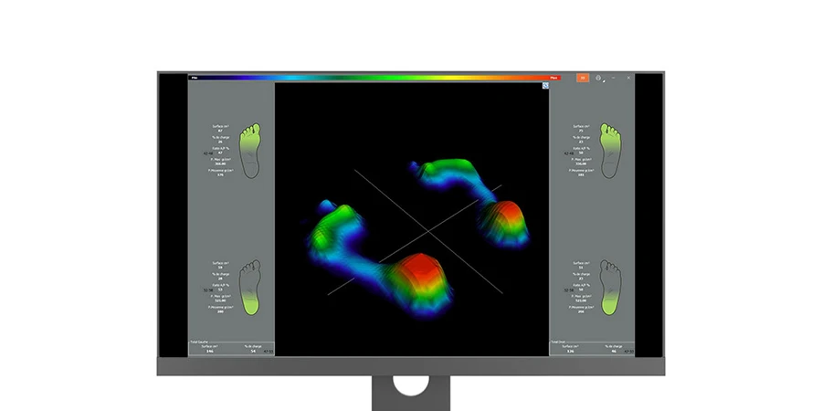 Image d'une vue de l'écran avec le logiciel freestep et deux empreintes de pieds en 3D avec les visualisations des points d'appuis du bleu, vert, orange au rouge
