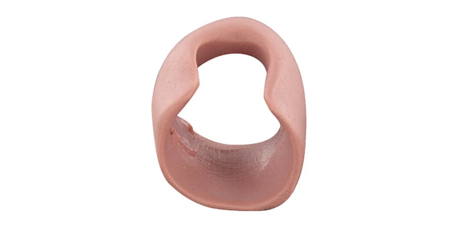 exemple d'orthoplastie avec du sicasil ferme