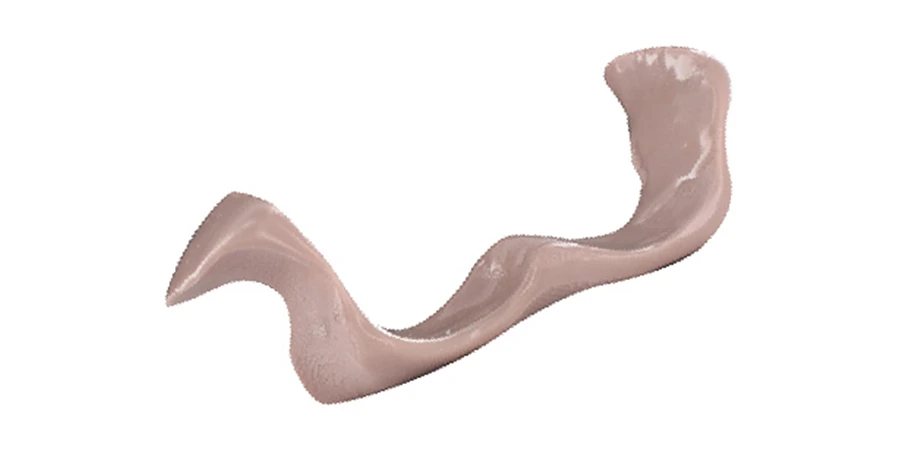 réalisation d'une orthoplastie avec Sicasil Super Souple