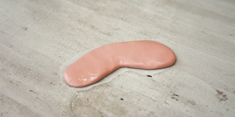 Silicone étalé à l'aide du rouleau d’application orthoplastie