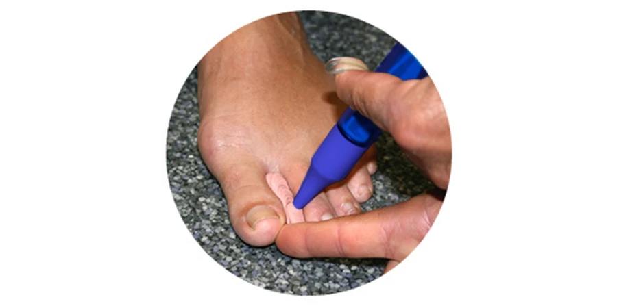 application de silicone à la seringue d'injection
