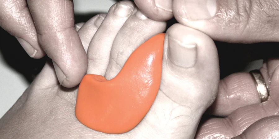application du Silicone Fresco Orthesil ferme sur un pied