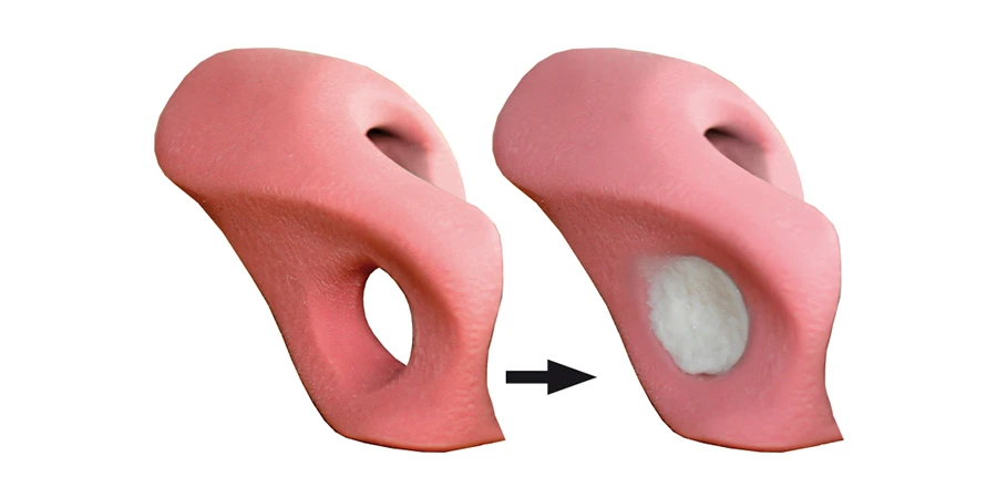 Trou bouché à l'aide du silicone liquide Fresco