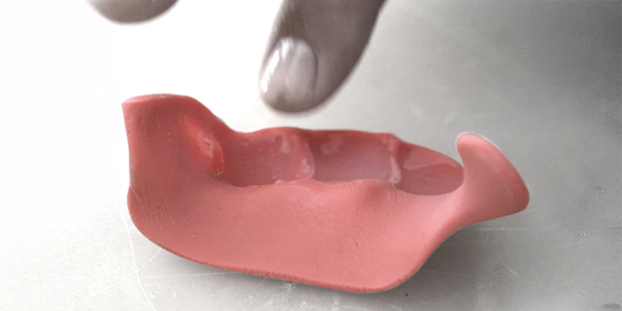 manipulation du silicone liquide polymère dans l'orthoplastie