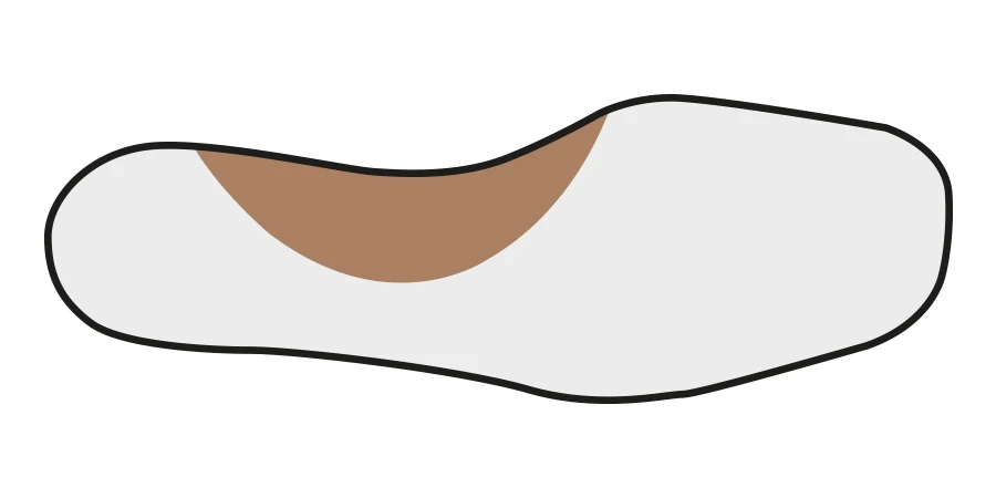voûte physiologique entoilée sur un pied