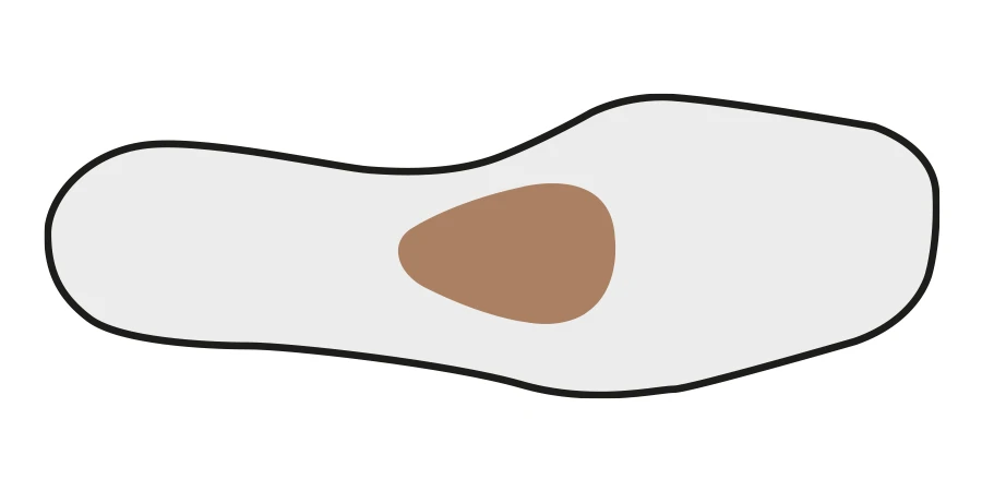 ARC ovoïde moulé sur pied