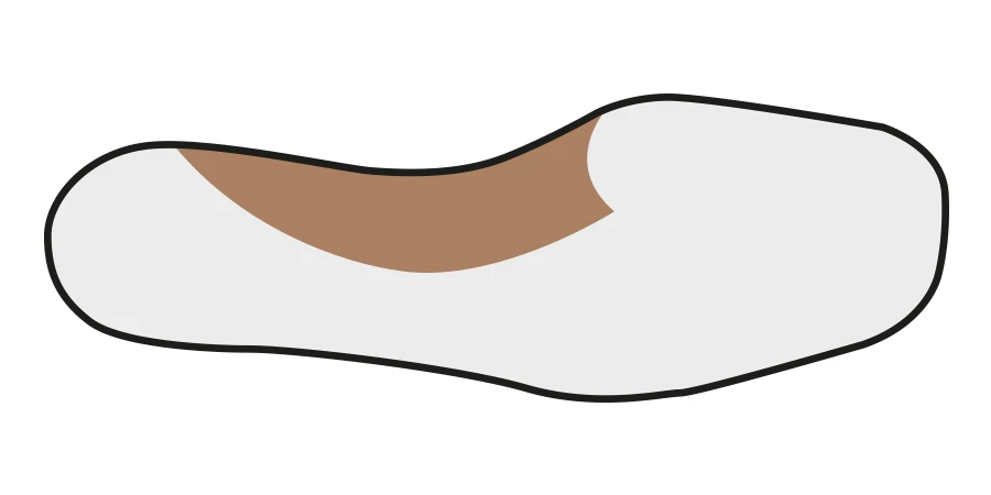 Hémi coupole du premier métatarsien sur un pied