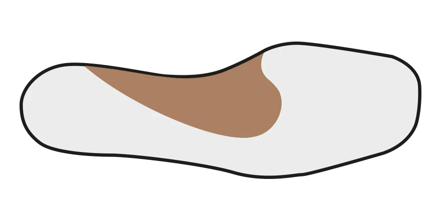 Voûte interne avec ARC sur un pied
