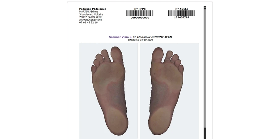 compte rendu cadélio pour un scan visioplus