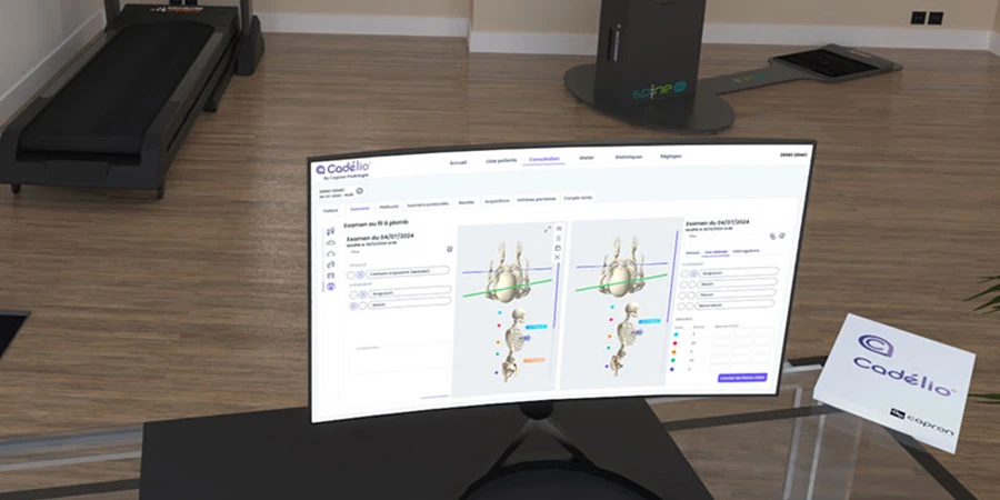 ordinateur avec cadélio ouvert dans un cabinet de podologie, on voit un tapis à capteur et un spine 3D en fond