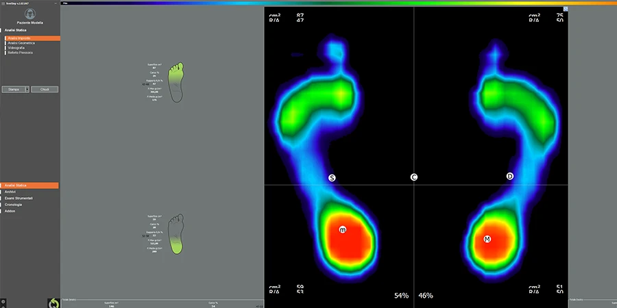 affichage d'empreintes de pieds sur le logiciel