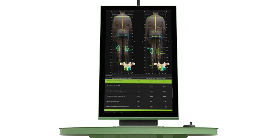 analyse posturale visible sur l'écran du spine 3D