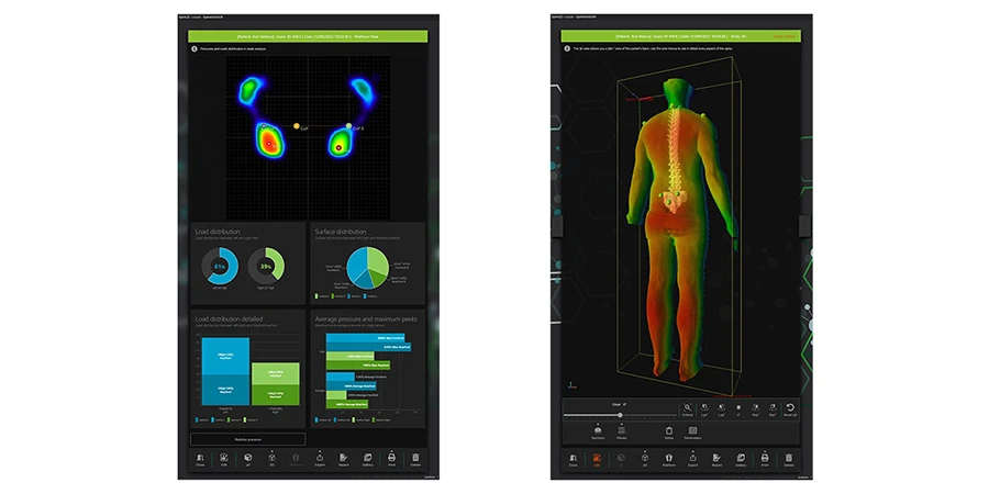capture d'écran du logiciel du spine 3d