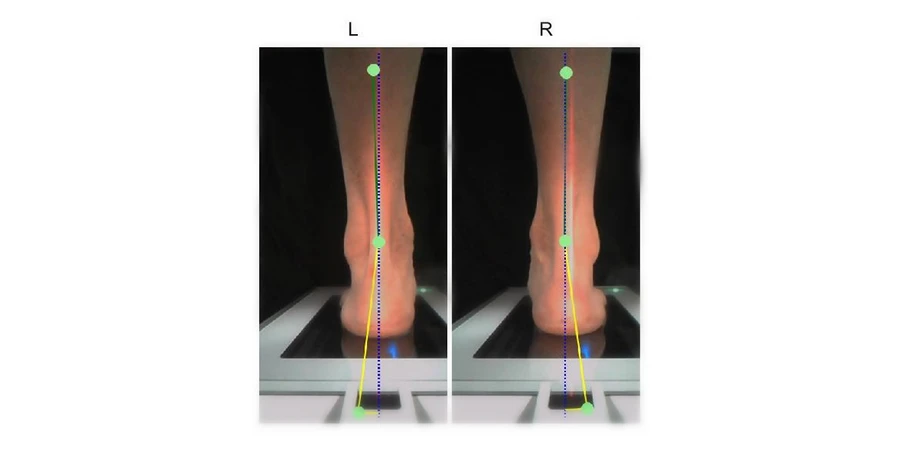 capture d'écran du logiciel qui analyse l'acquisition du scanner 3D