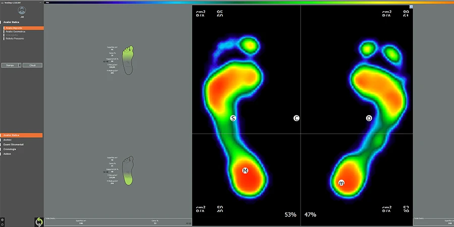 vision sur les pieds dans le logiciel du freemed 